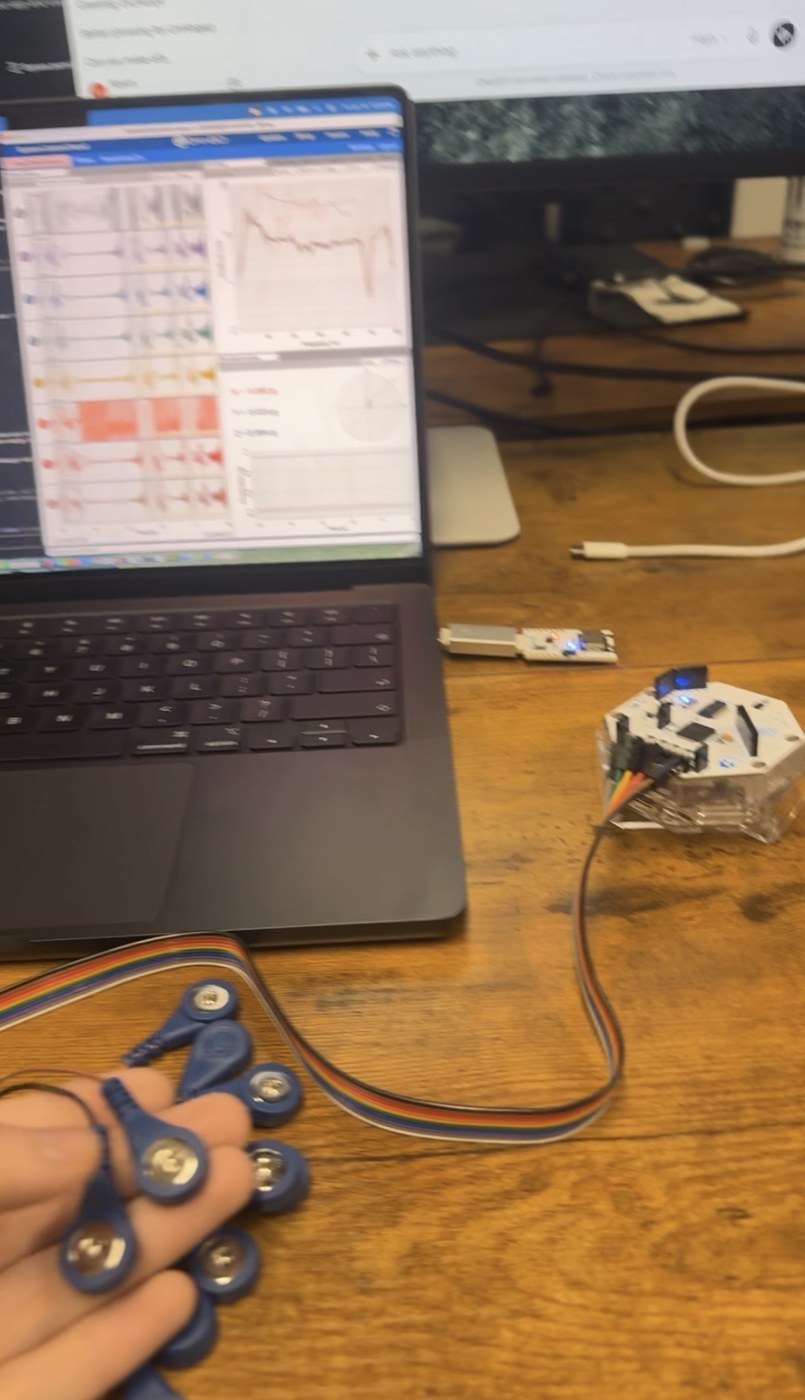 EMG snap electrodes in hand beside the OpenBCI board and a laptop running the multi-channel signal GUI